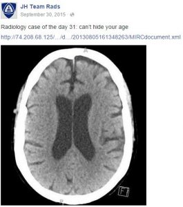 MRI of the brain