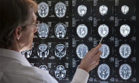 doctor checking brain scans