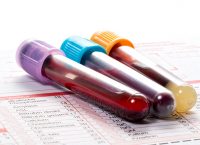 A Blood Test for Alzheimer’s Disease? Breakthroughs and Limitations