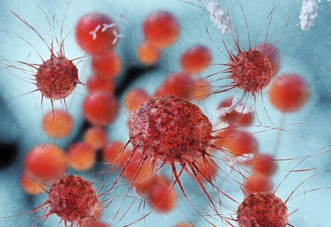 A rendered illustration of cancer cells.