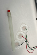 Close-up of EMG needle (left in image) and NCS/EMG electrodes (right in image).