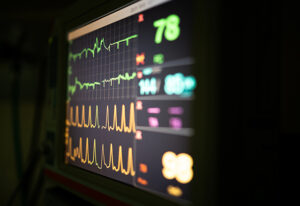 Monitor of vital signs in the operating room
